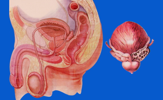 Vô sinh hiếm muộn - biến chứng của viêm tuyến tiền liệt gây ra